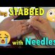 Being Stabbed by Needles | May 25th, 2017 | Vlog #125